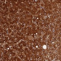 Anti-FAM118B antibody produced in rabbit 