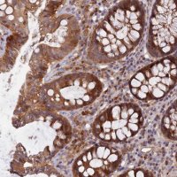 Anti-FAM151B antibody produced in rabbit 