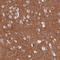 Anti-FAM155A antibody produced in rabbit 