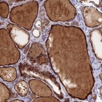 Anti-FAM160A1 antibody produced in rabbit 