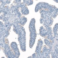 Anti-FAM161A antibody produced in rabbit 
