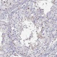 Anti-FAM166A antibody produced in rabbit 