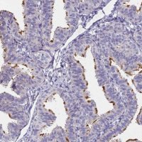 Anti-FAM166B antibody produced in rabbit 