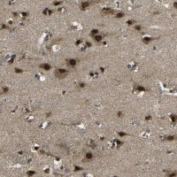 Anti-FAM172A antibody produced in rabbit 
