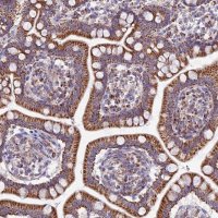 Anti-FAM186B antibody produced in rabbit 