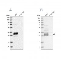 Anti-FAM221A antibody produced in rabbit 