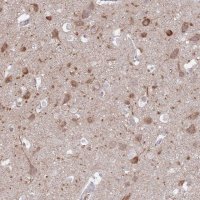 Anti-FAM69C antibody produced in rabbit 