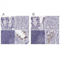 Anti-FAM71B antibody produced in rabbit 