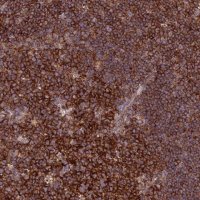 Anti-FAM76A antibody produced in rabbit HPA044762-100UL
