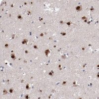 Anti-FAM81A antibody produced in rabbit 