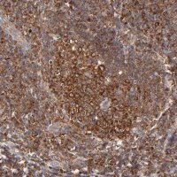 Anti-FARSA antibody produced in rabbit 