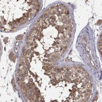 Anti-FARSB antibody produced in rabbit 