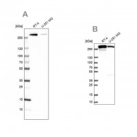 Anti-FASN antibody produced in rabbit 