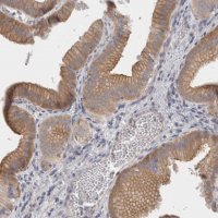 Anti-FBLIM1 antibody produced in rabbit 
