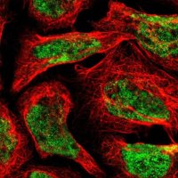 Anti-FBXL6 antibody produced in rabbit HPA008867-100UL