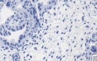 Anti-FCGR2B/CD32 Antibody, clone 3G17 ZooMAb Rabbit Monoclonal 