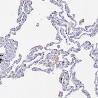 Anti-FCGR3A antibody produced in rabbit 