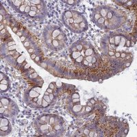 Anti-FERD3L antibody produced in rabbit 