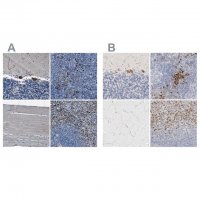 Anti-FGL2 antibody produced in rabbit HPA021011-100UL