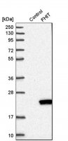 Anti-FHIT antibody produced in rabbit HPA018840-100UL
