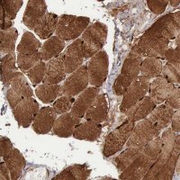 Anti-FHL1 antibody produced in rabbit 