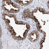 Anti-FIBP antibody produced in rabbit 