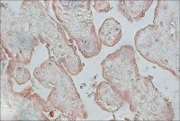 Anti-Fibroblast Growth Factor Receptor-2, Cytoplasmic antibody produced in rabbit F0300-.5ML