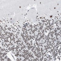 Anti-FIP1L1 antibody produced in rabbit 