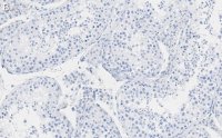 Anti-FKBP52 Antibody, clone 4H21 ZooMAb Rabbit Monoclonal 
