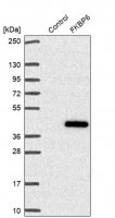 Anti-FKBP6 antibody produced in rabbit HPA061109-100UL