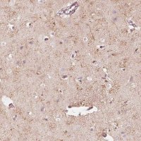 Anti-FMNL2 antibody produced in rabbit 