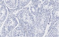 Anti-FMR1 (C-terminal) Antibody, clone 2B16 ZooMAb Rabbit Monoclonal 