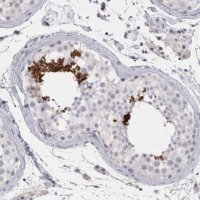 Anti-FNDC8 antibody produced in rabbit 