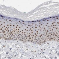 Anti-FOSL2 antibody produced in rabbit 
