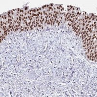 Anti-FOXA1 antibody produced in rabbit 