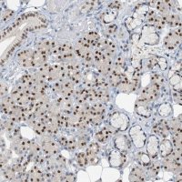 Anti-FOXC1 antibody produced in rabbit 