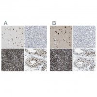 Anti-FOXK1 antibody produced in rabbit HPA018864-100UL