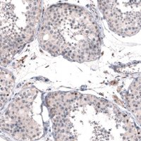 Anti-FOXM1 antibody produced in rabbit 