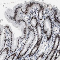 Anti-FOXP4 antibody produced in rabbit 