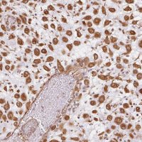 Anti-FOXR2 antibody produced in rabbit 