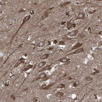 Anti-FOXRED2 antibody produced in rabbit 