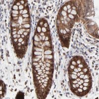 Anti-FRMD8 antibody produced in rabbit 