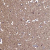 Anti-FRRS1L antibody produced in rabbit 