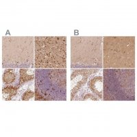 Anti-FSCN1 antibody produced in rabbit 