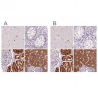 Anti-FTCD antibody produced in rabbit 