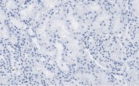 Anti-FTO Antibody, clone 4B21 ZooMAb Rabbit Monoclonal 