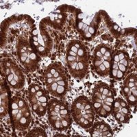 Anti-FUBP3 antibody produced in rabbit 