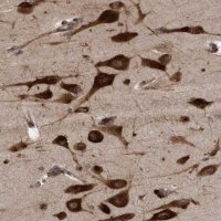 Anti-FXR2 antibody produced in rabbit 