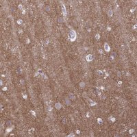 Anti-GABBR2 antibody produced in rabbit 