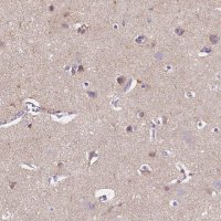 Anti-GABRD antibody produced in rabbit 